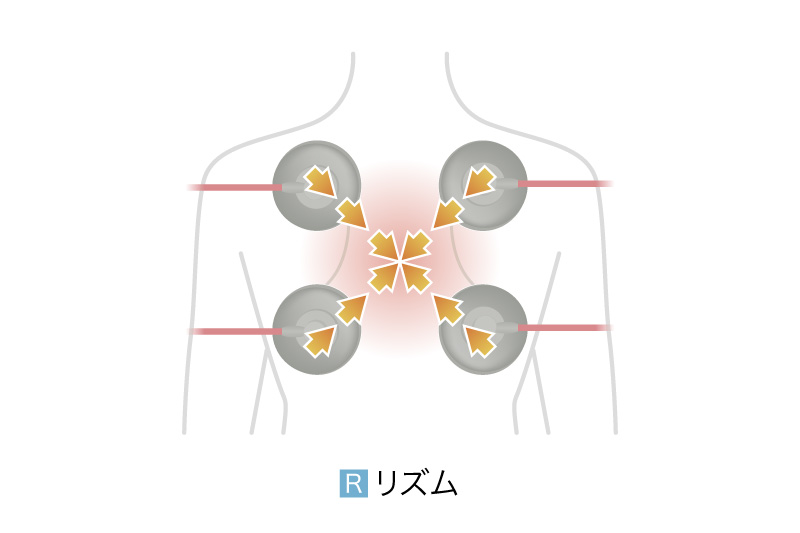 AUDIOTRON | 電気刺激療法 | オージーウエルネス