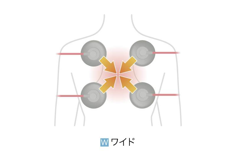 AUDIOTRON | 電気刺激療法 | オージーウエルネス
