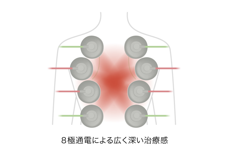 AUDIOTRON | 電気刺激療法 | オージーウエルネス